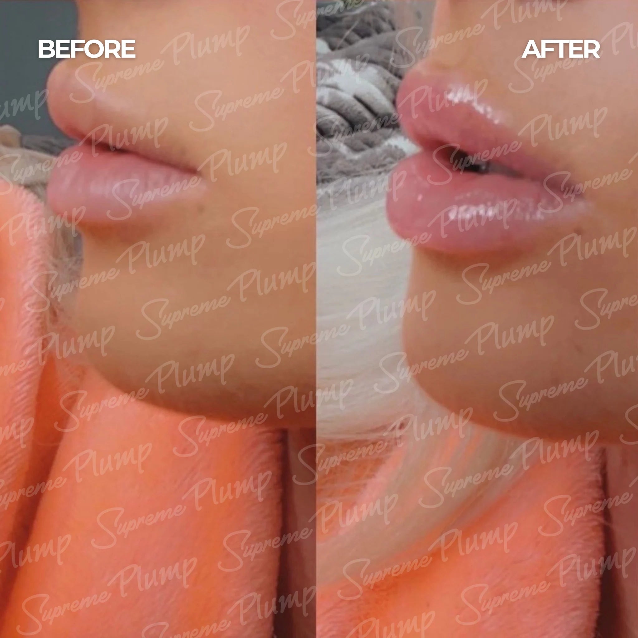 Alure - Volumizant pentru Buze SupremePlump