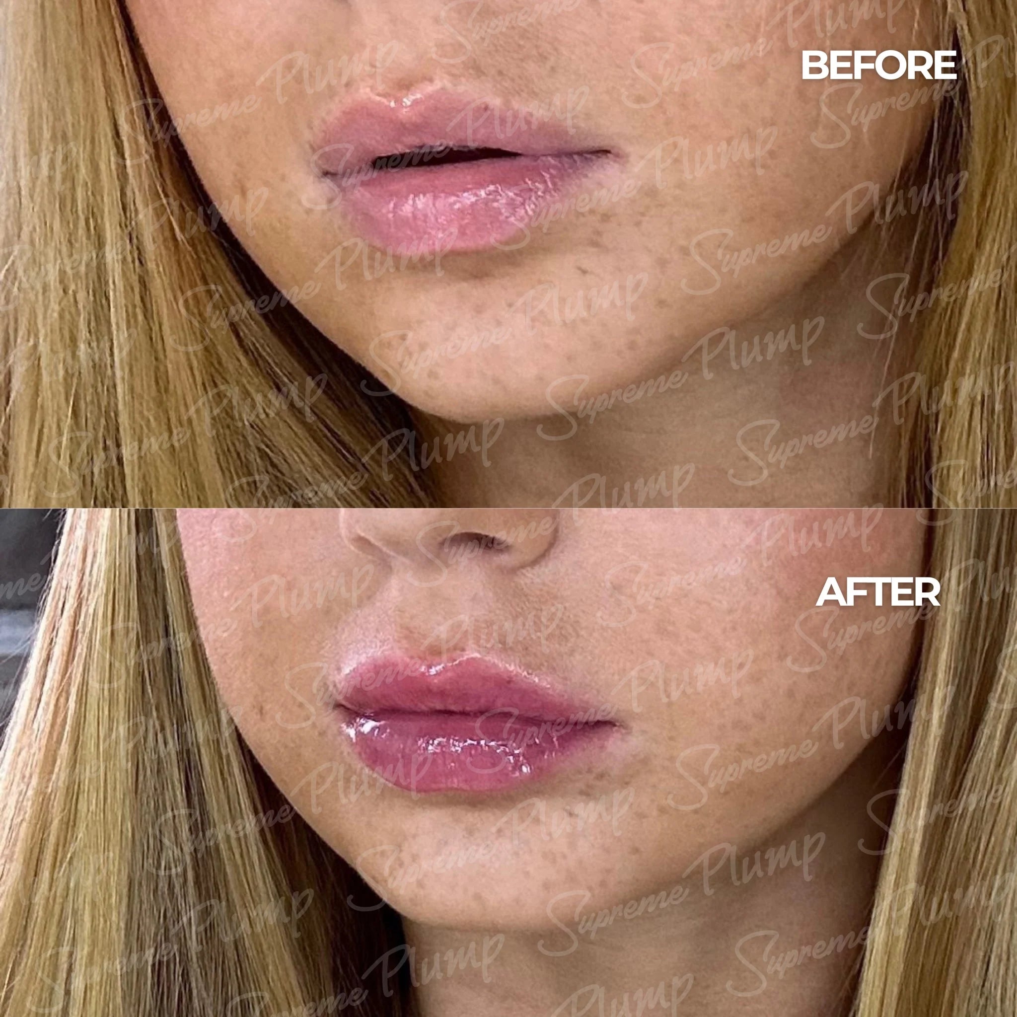 Alure - Volumizant pentru Buze SupremePlump